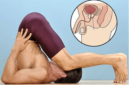 prostatitis