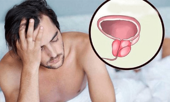 Symptomen van prostatitis