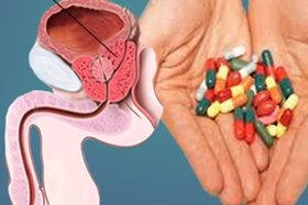 geneesmiddelen voor de behandeling van prostatitis
